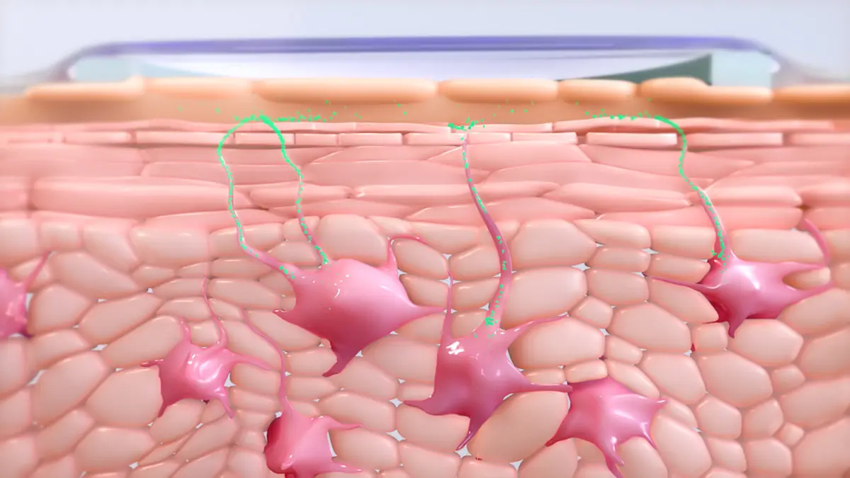 electrospray technology is crucial to the Viaskin patch